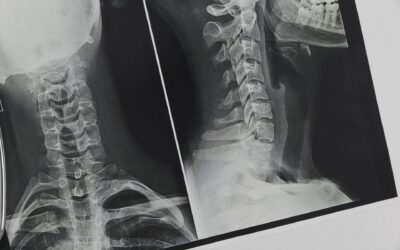 Radiologický/á laborant/ka